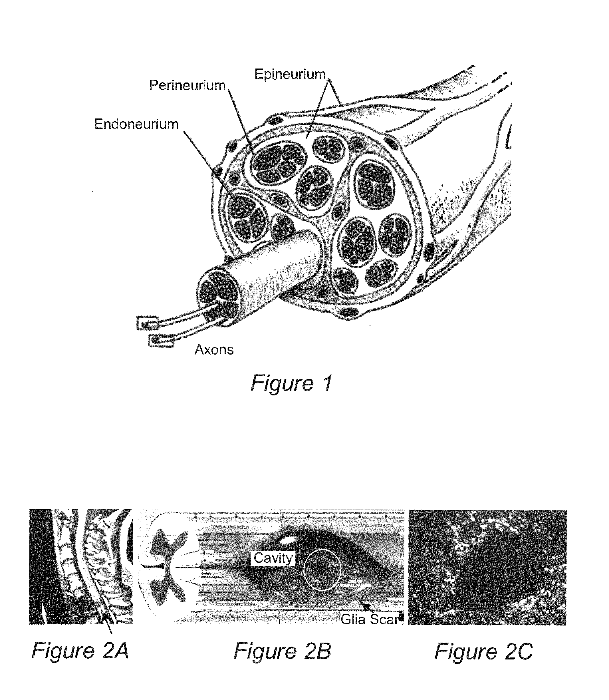 Electrospun nerve guides for nerve regeneration designed to modulate nerve architecture