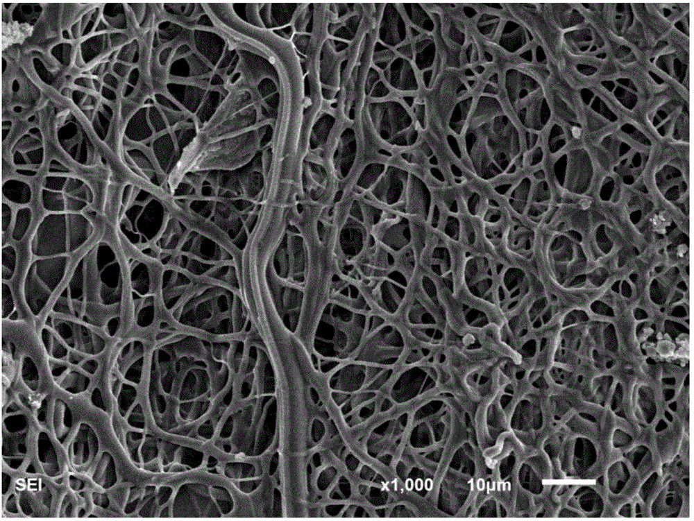 Reinforced ligament tissue engineering scaffold and preparation method for same