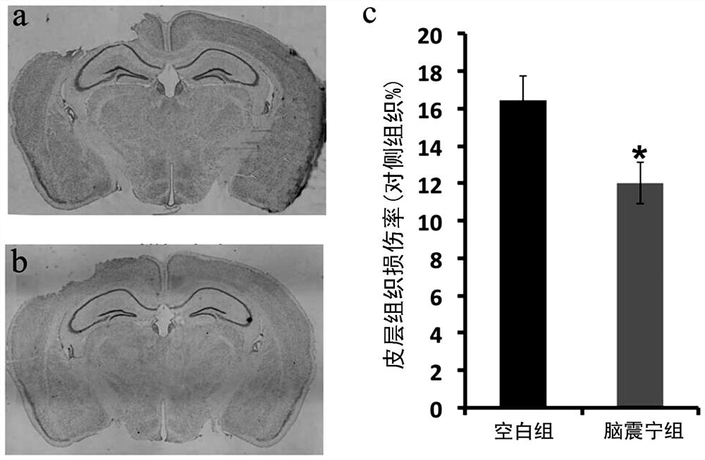 New Pharmaceutical Application of Naozhenning Preparation