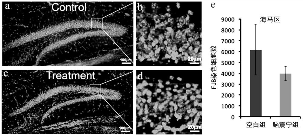 New Pharmaceutical Application of Naozhenning Preparation