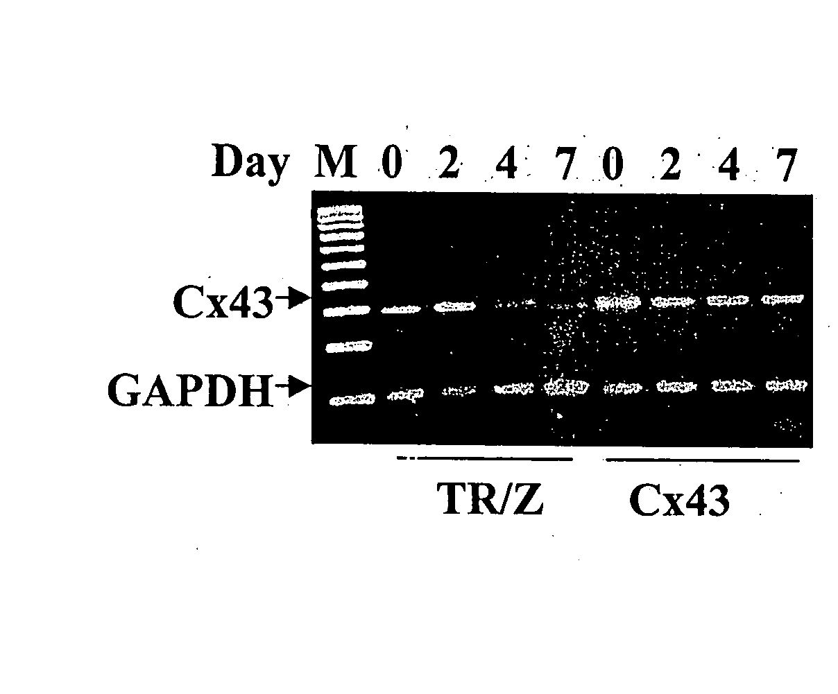 Methods and compositions for correction of cardiac conduction disturbances