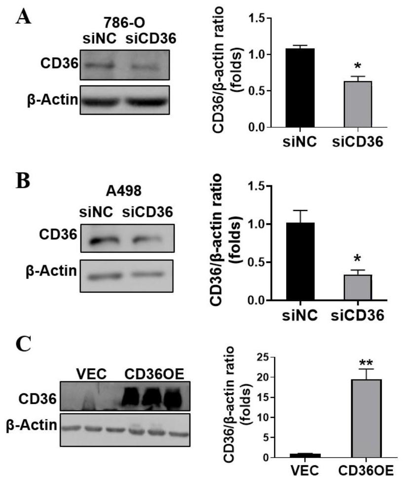 Application of fatty acid transporter CD36 and inhibitor thereof in treatment and diagnosis of renal clear cell carcinoma