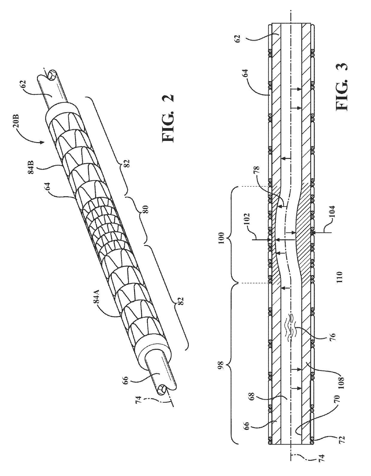 Inflatable structural member