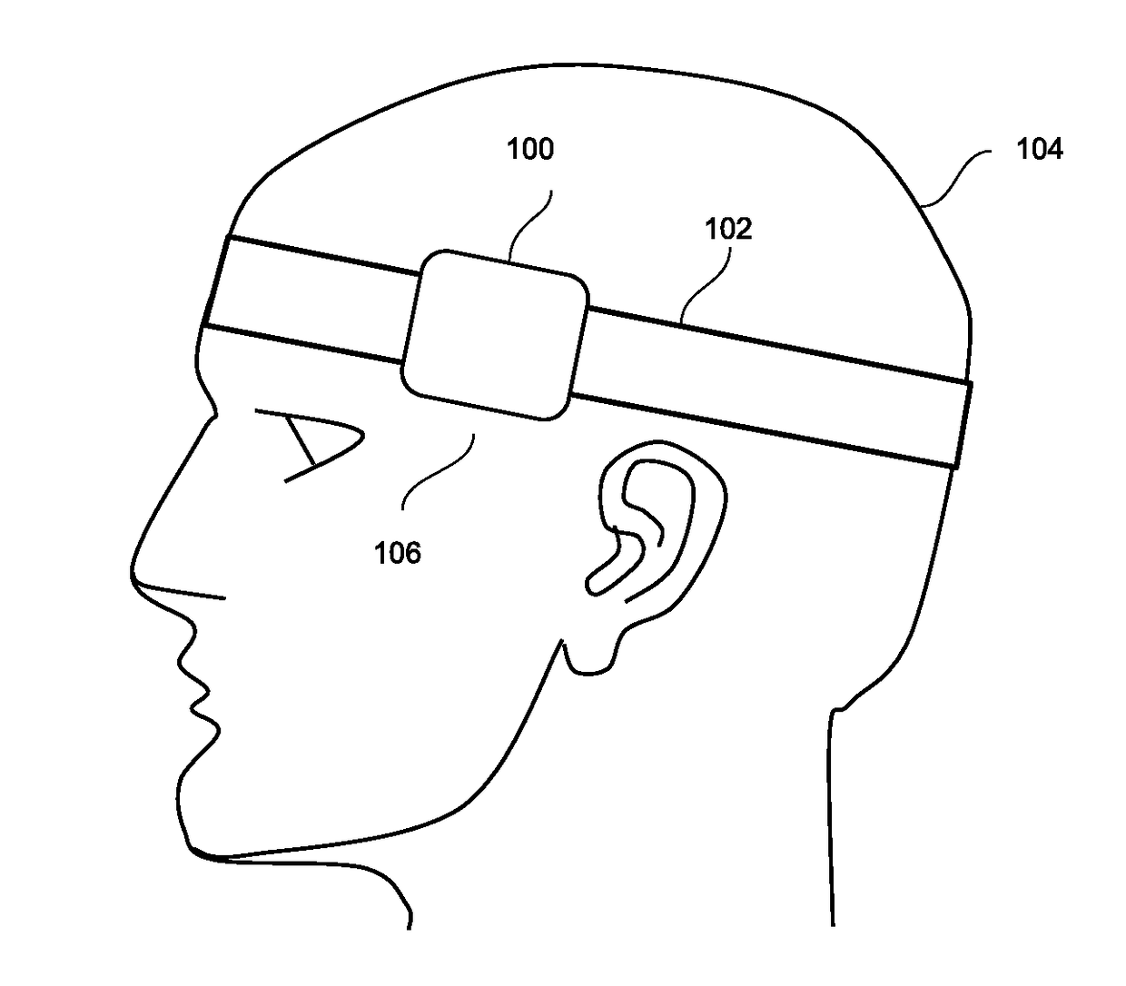 Bruxism tracking and reduction device and methods