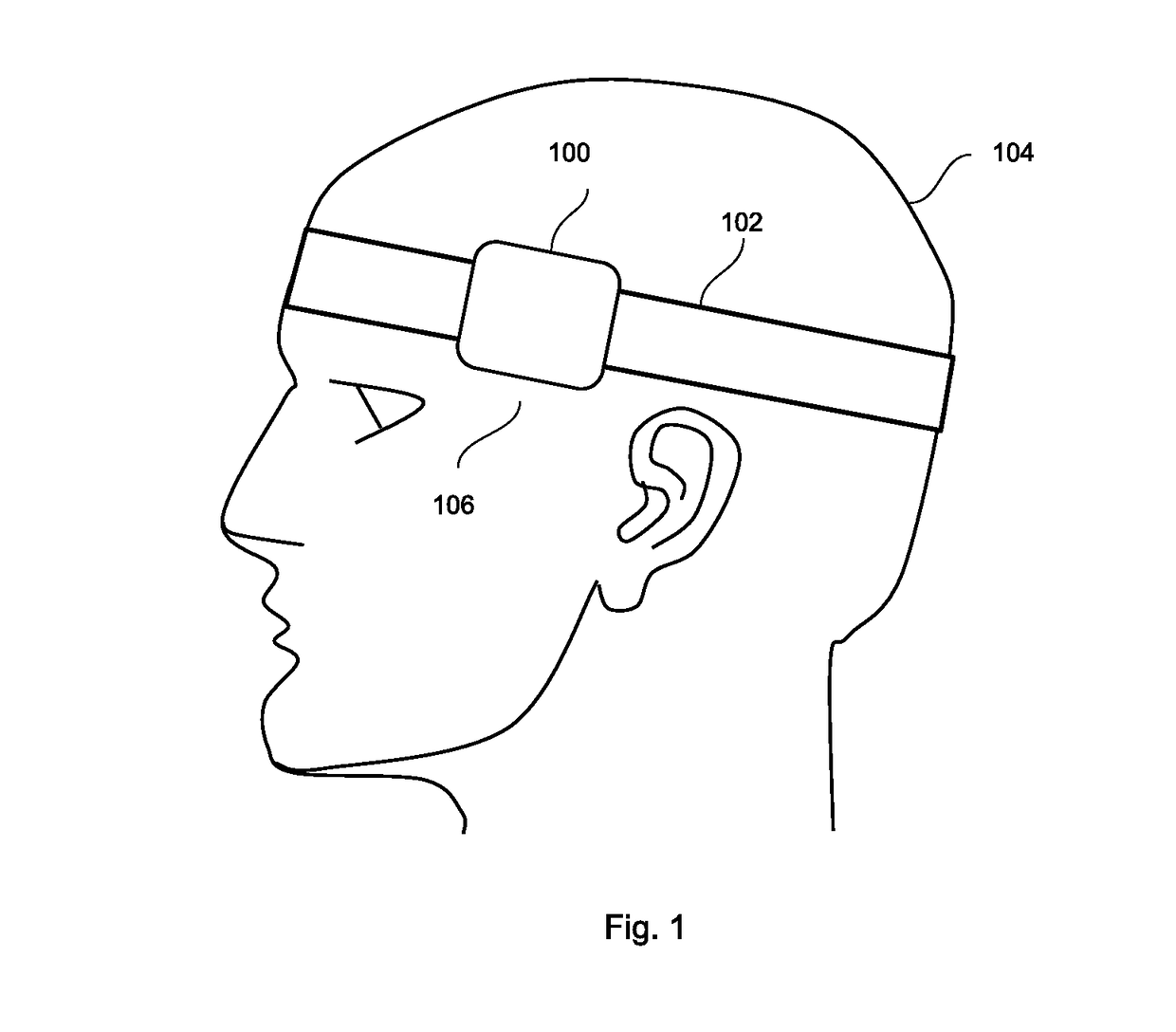 Bruxism tracking and reduction device and methods