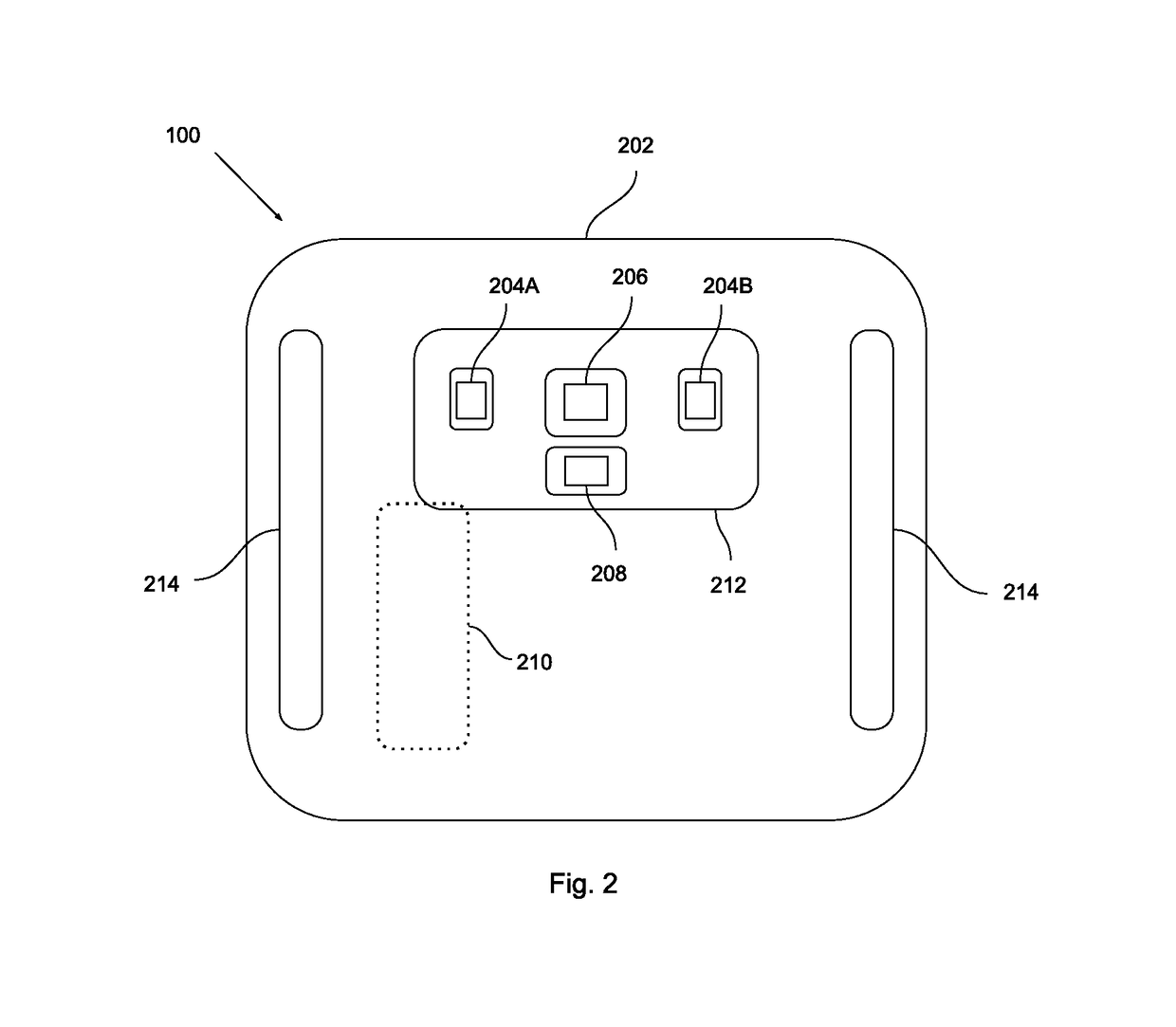 Bruxism tracking and reduction device and methods