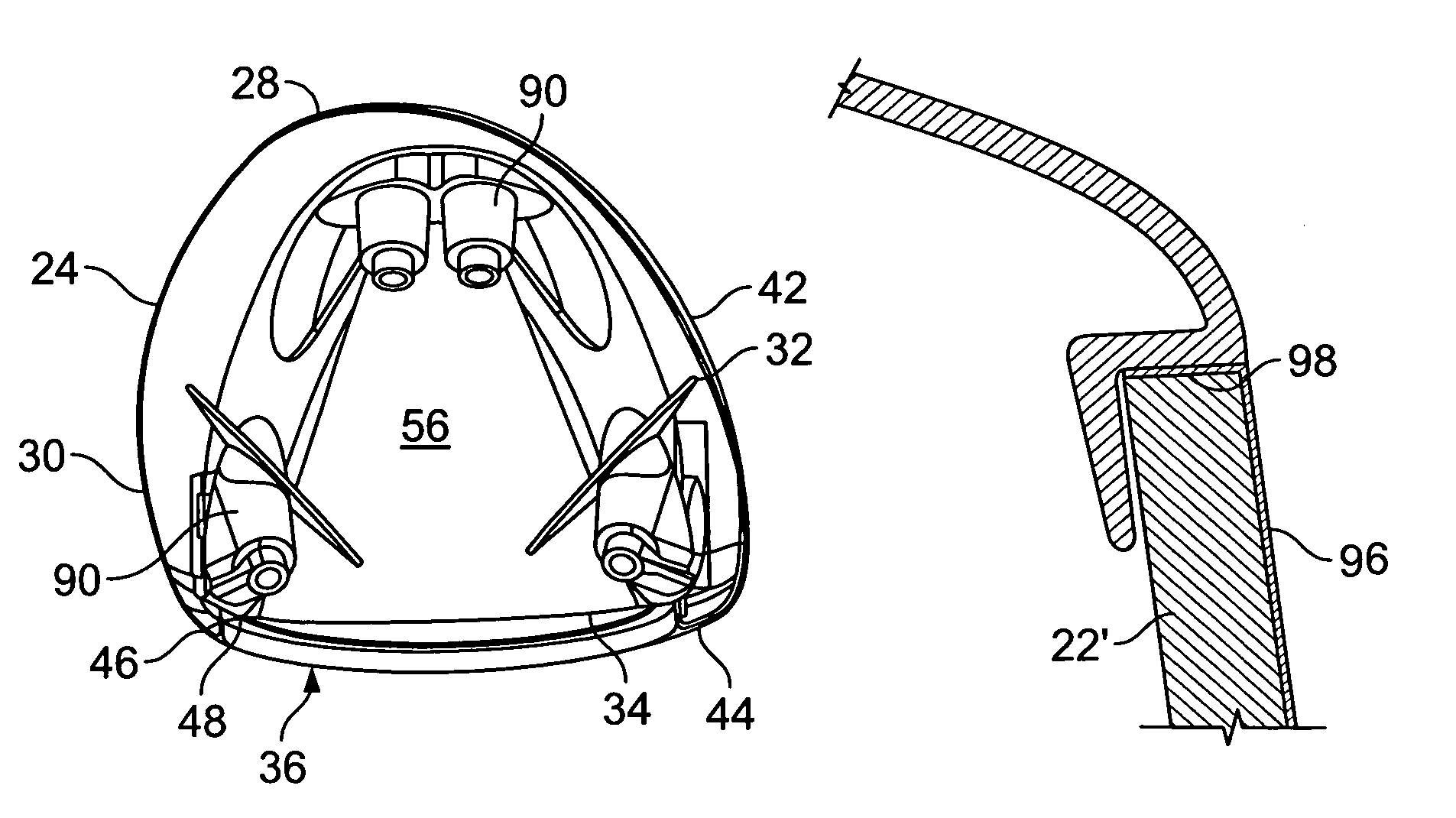 Golf club head