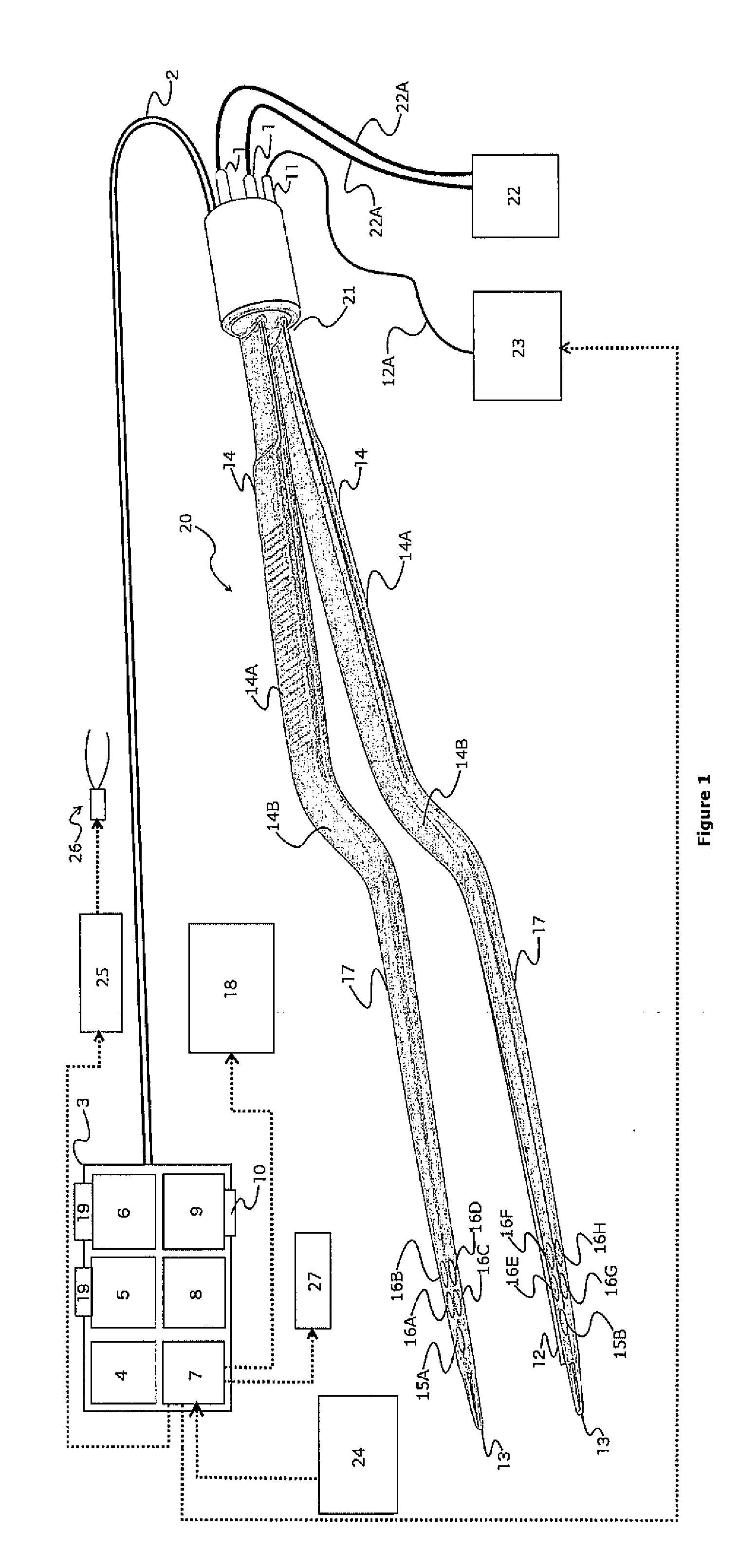 Bipolar Forceps with Force Measurement