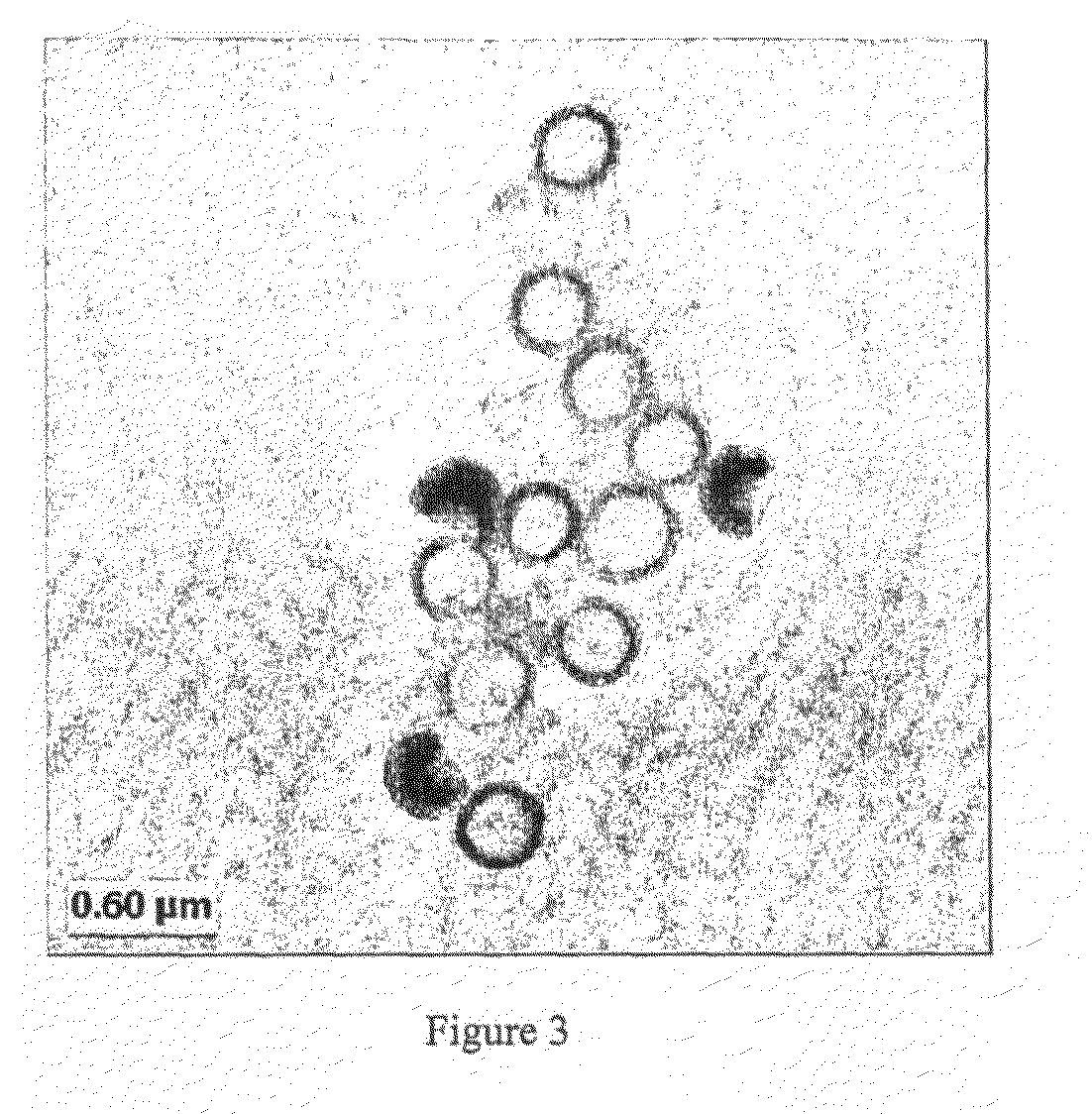 Vesiculated polymer particles