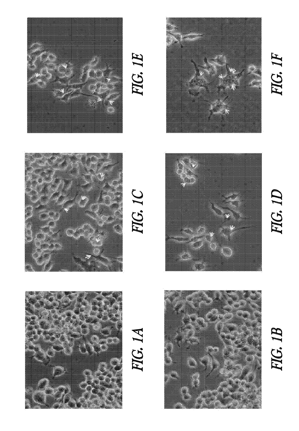 Reduction of implant infection via tunable stimulation of localized adaptive immune response