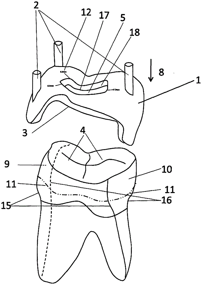 Guiding device for tooth coronal cavity preparation and making method thereof