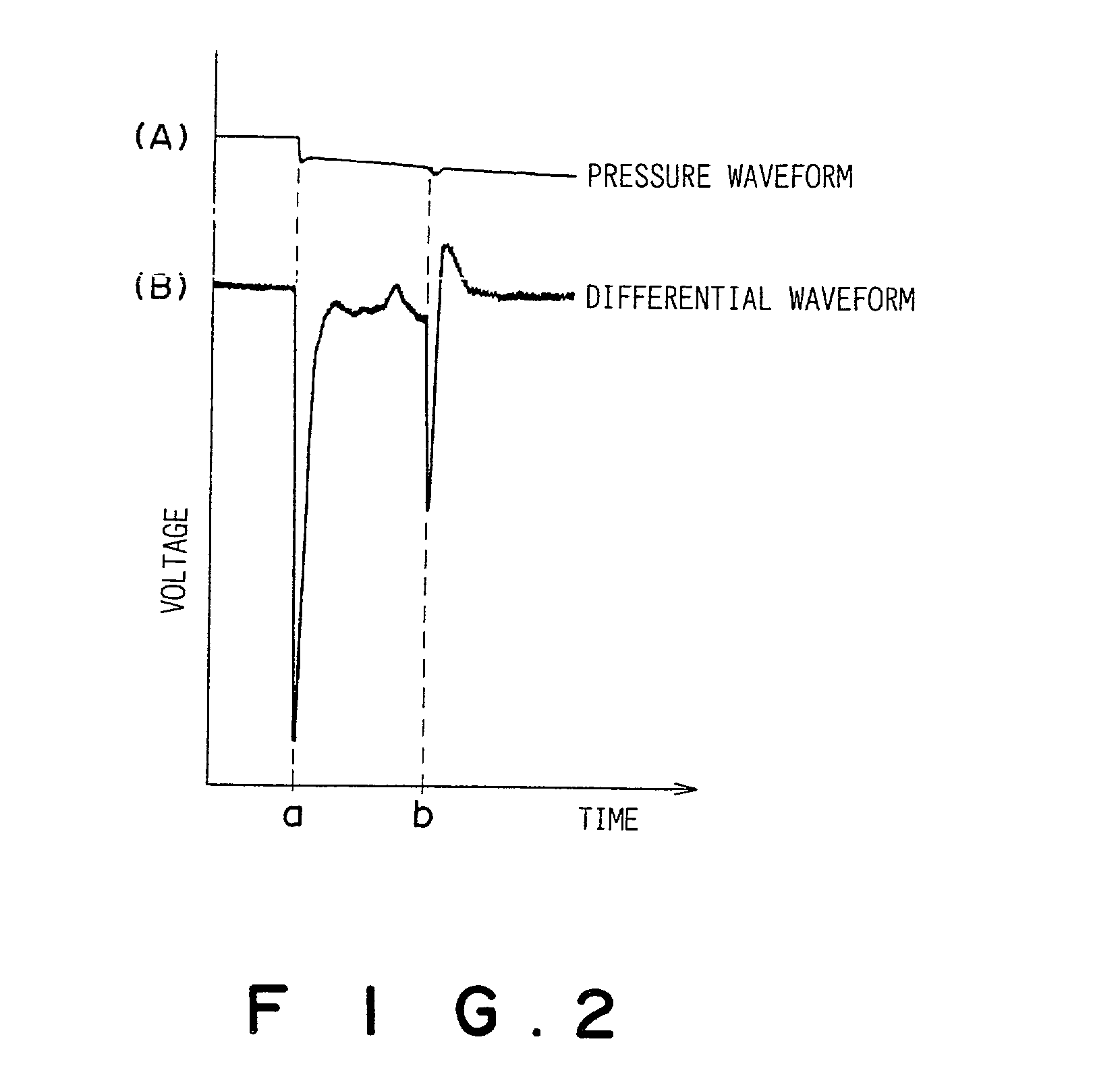 Quantitative suction tip and quantitative suction apparatus