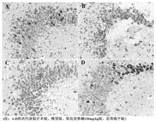 Application of oxymatrine in medicines for treating neonatal hypoxic ischemic brain damages