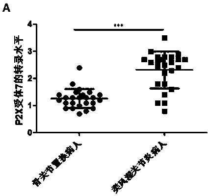 Application of P2X7 receptor in diagnosis and treatment of rheumatoid arthritis