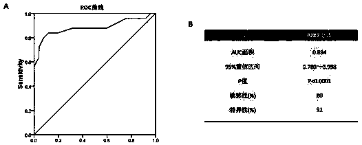 Application of P2X7 receptor in diagnosis and treatment of rheumatoid arthritis