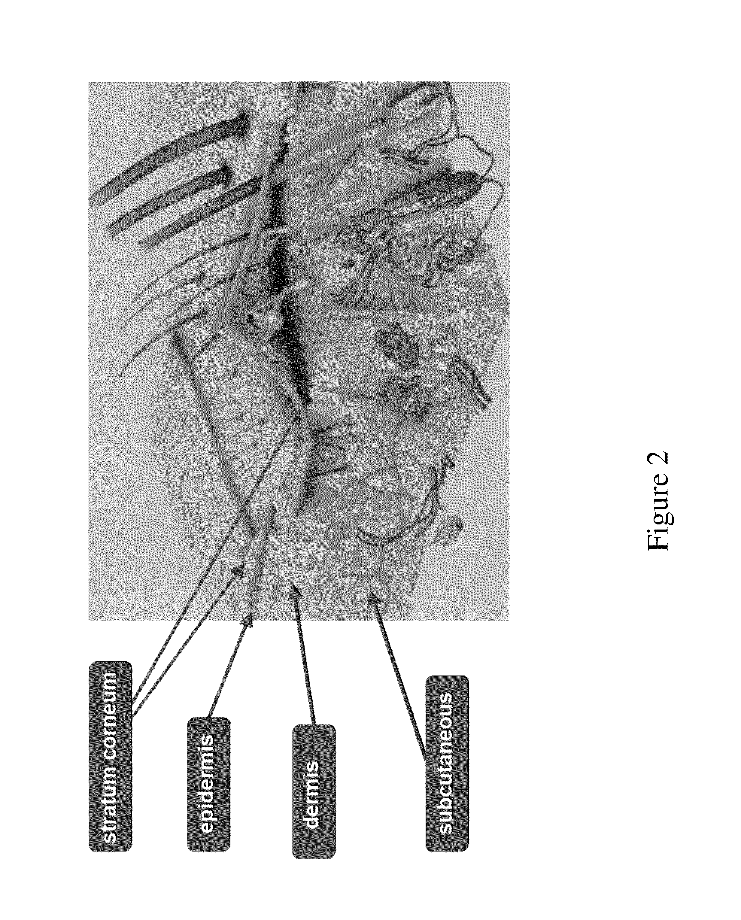 System for noninvasive determination of analytes in tissue