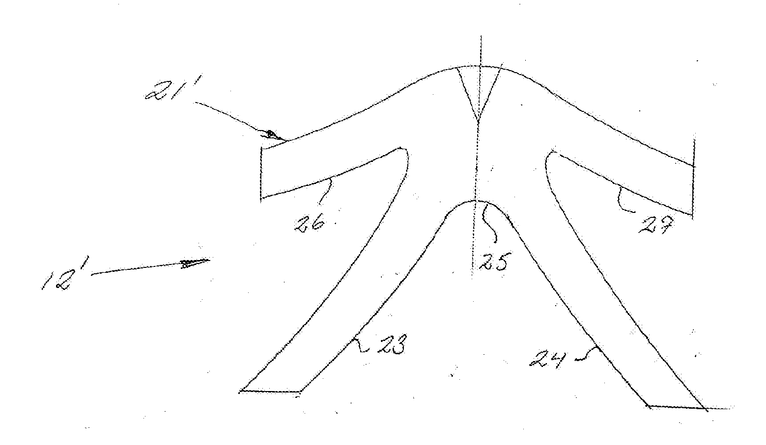 Ligament support for hooves