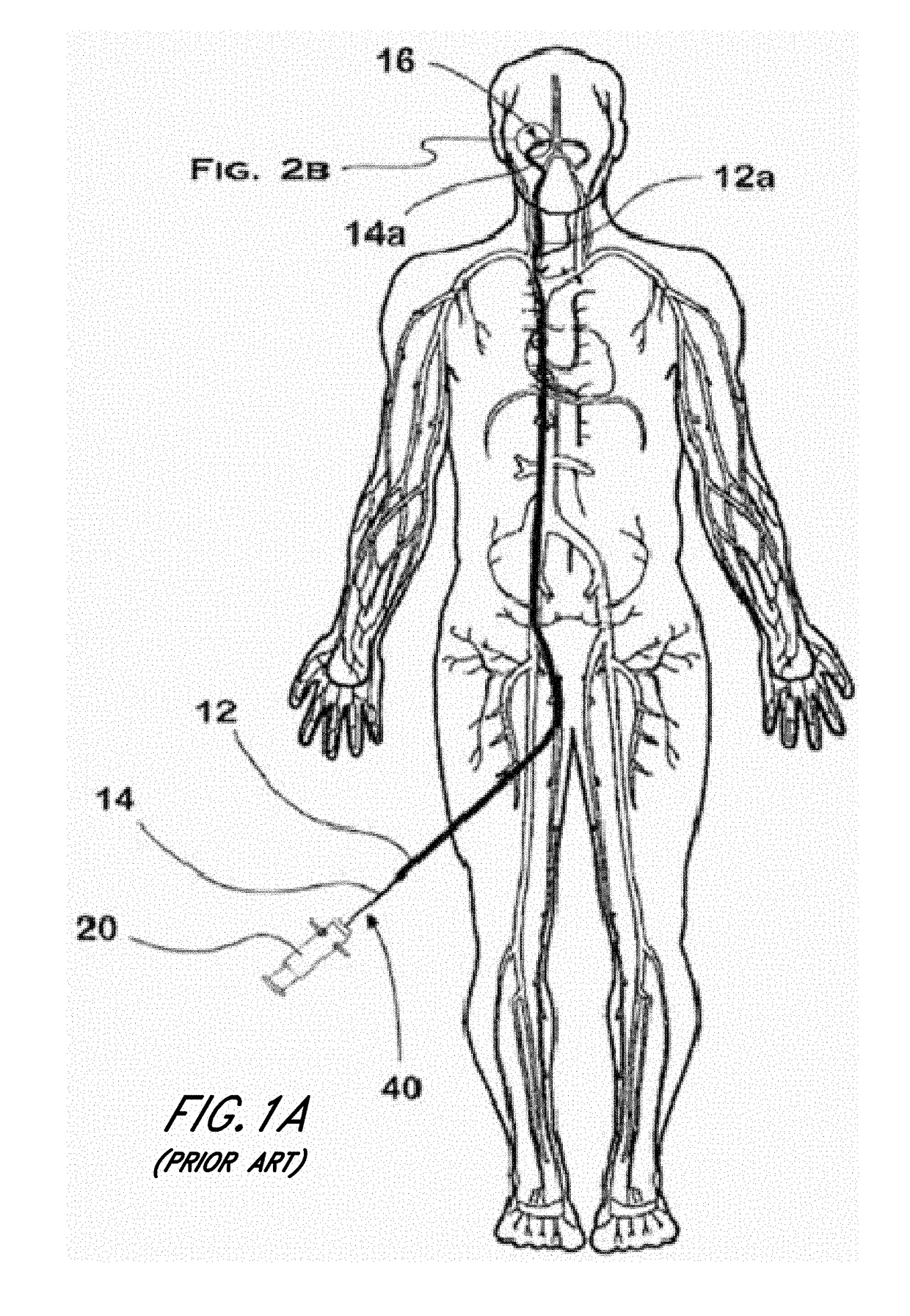 Thromboresistant coatings for aneurysm treatment devices