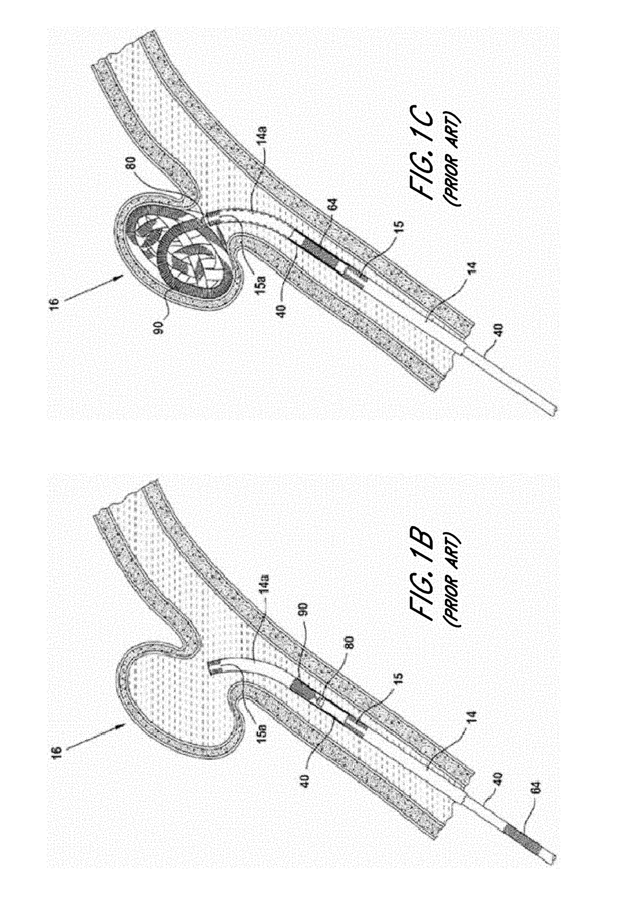 Thromboresistant coatings for aneurysm treatment devices