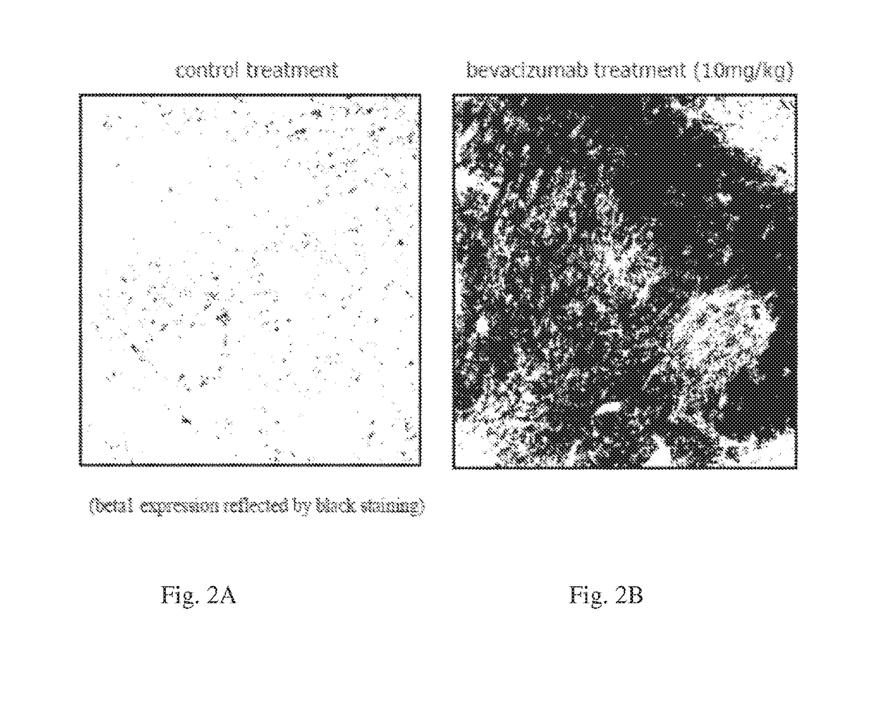 Methods and Compositions for Improving Antiangiogenic Therapy with Anti-Integrins