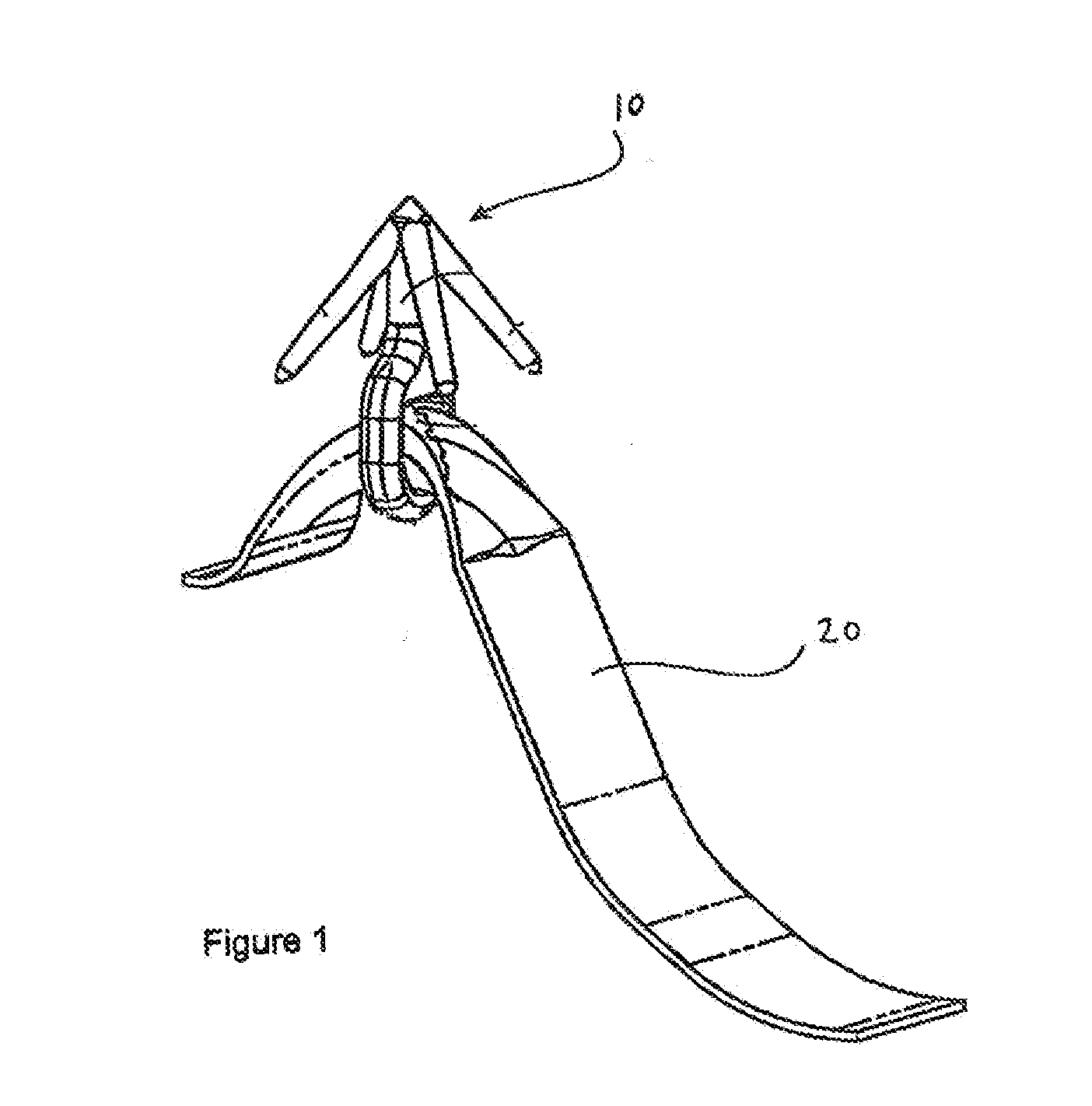 Method of Performing a Mastopexy Procedure