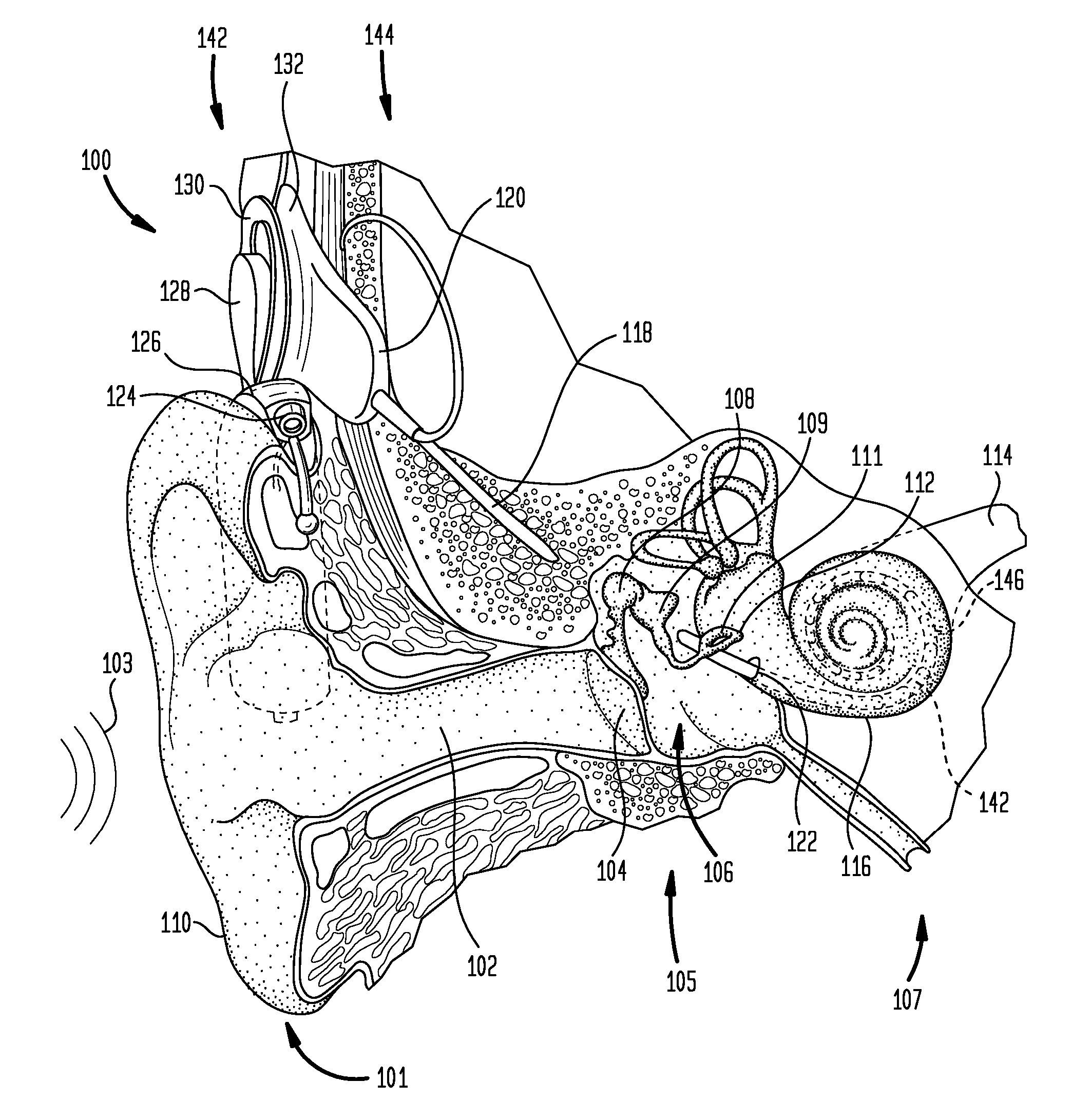 Automatic Measurement Of Neural Response Concurrent With Psychophysics Measurement Of Stimulating Device Recipient