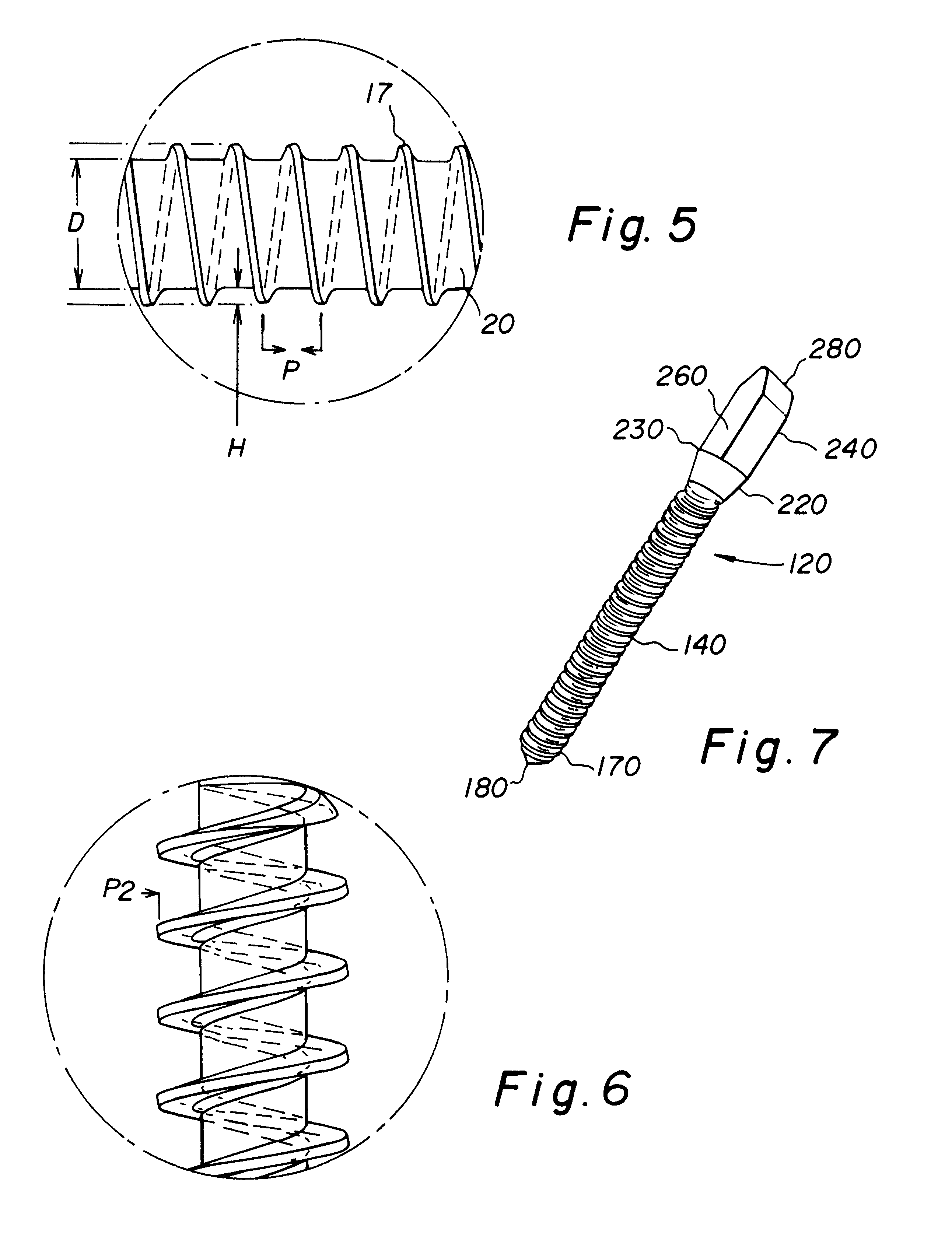 Allograft bone fixation screw