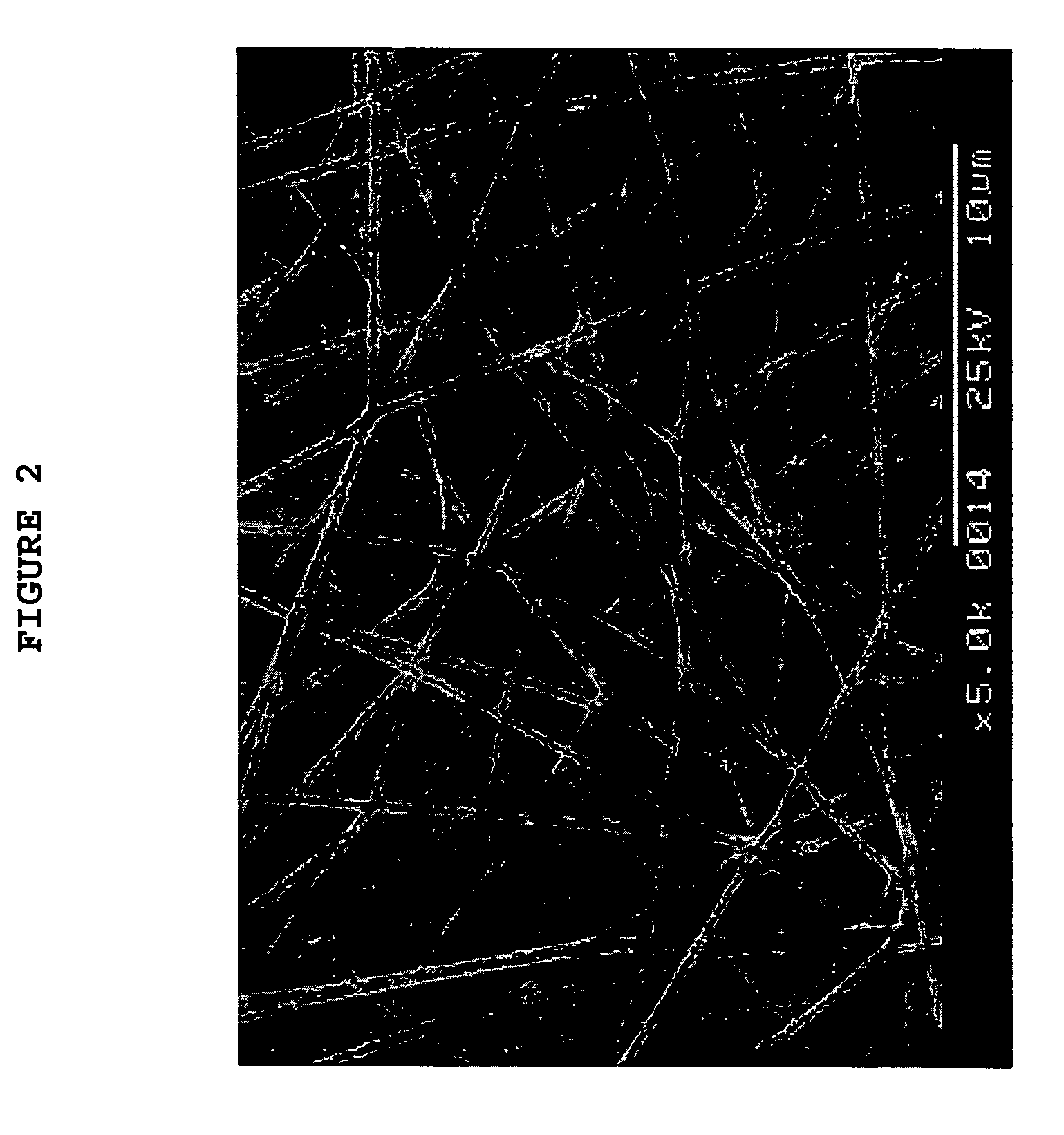 Nanofibrous nonwoven membrane of silk fibroin for guided bone tissue regeneration and manufacturing method thereof