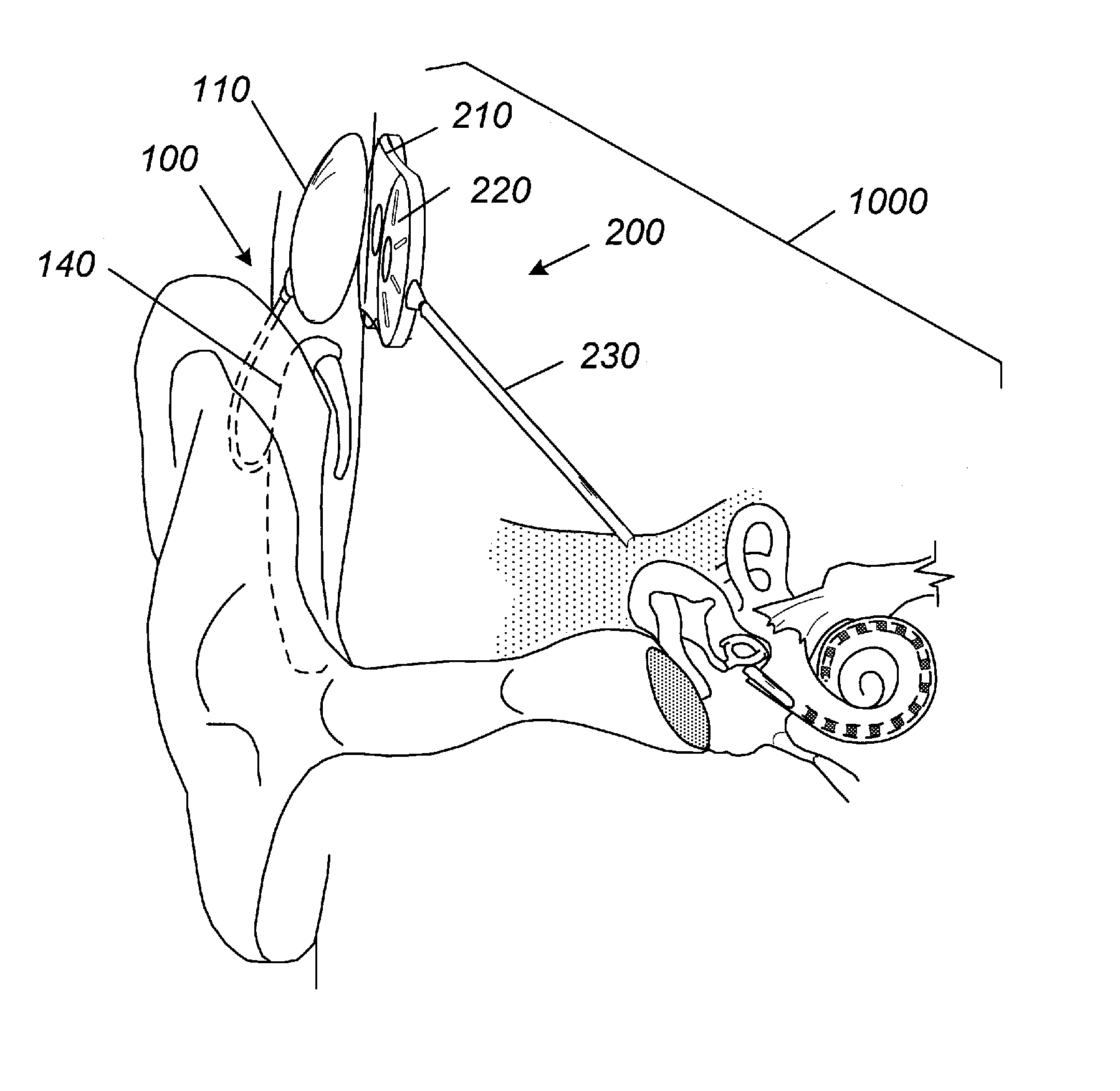 Waterproof acoustic element enclosures and apparatus including the same