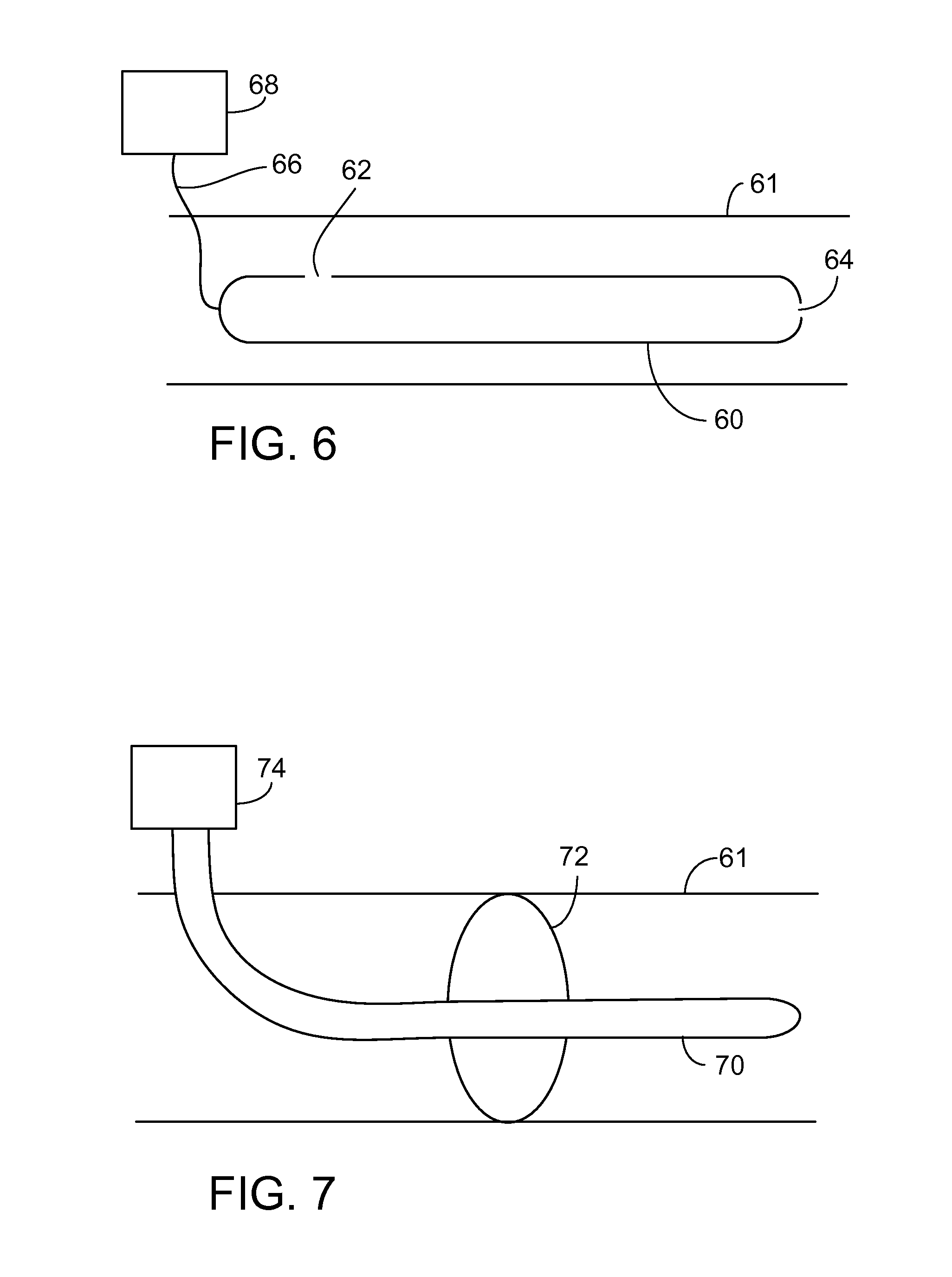 Disrupting electrical activity in the stomach