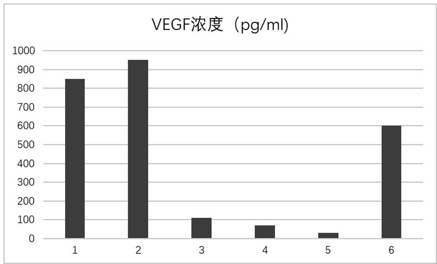 Stem cell extract and preparation method and application thereof