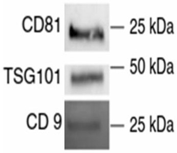 Stem cell extract and preparation method and application thereof