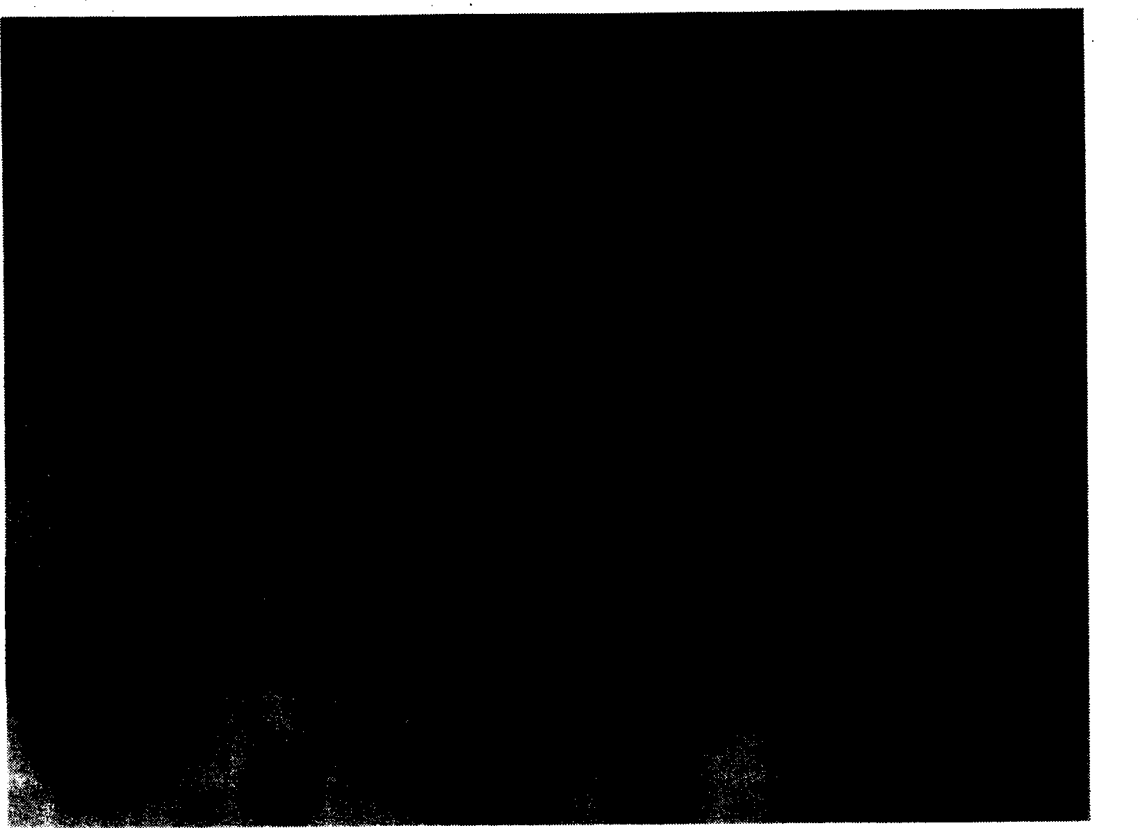 Putamen pattern cellulose stainless steel powder compounded microballons and the preparation process thereof