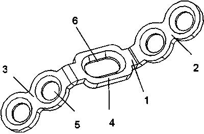 Posterior cervical single-door bone plate