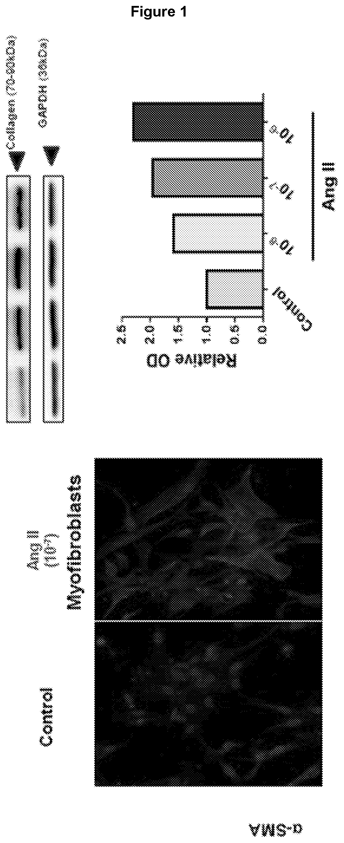 Angiotensin receptor agonists and uses thereof