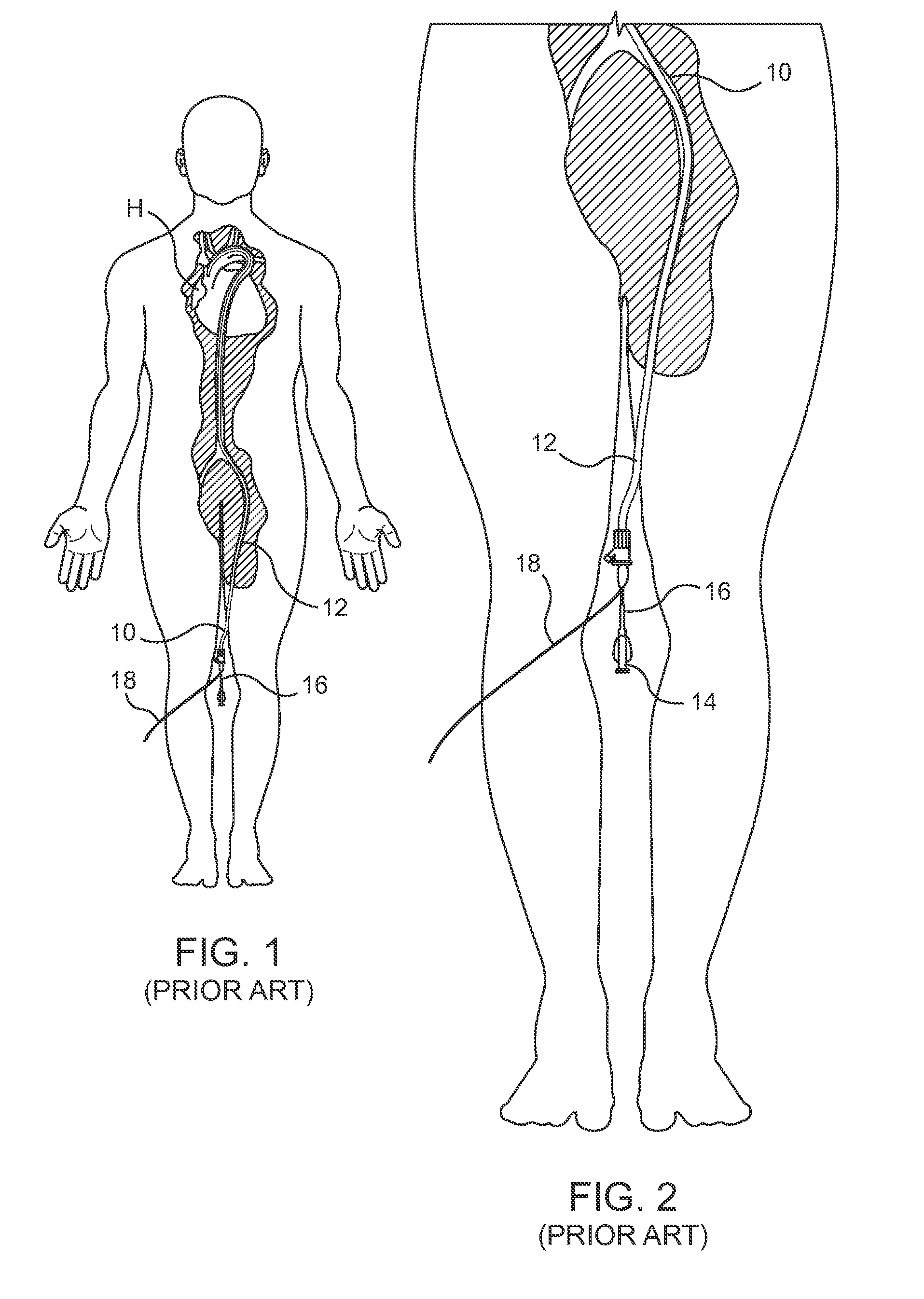 Sterile molded dispenser