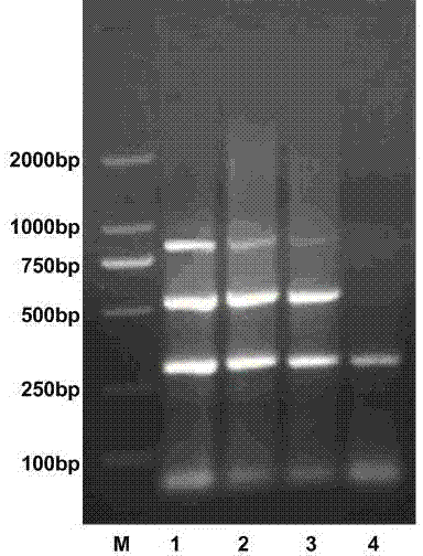 Kit and preparation method for identifying and detecting a variety of sheep Theileria