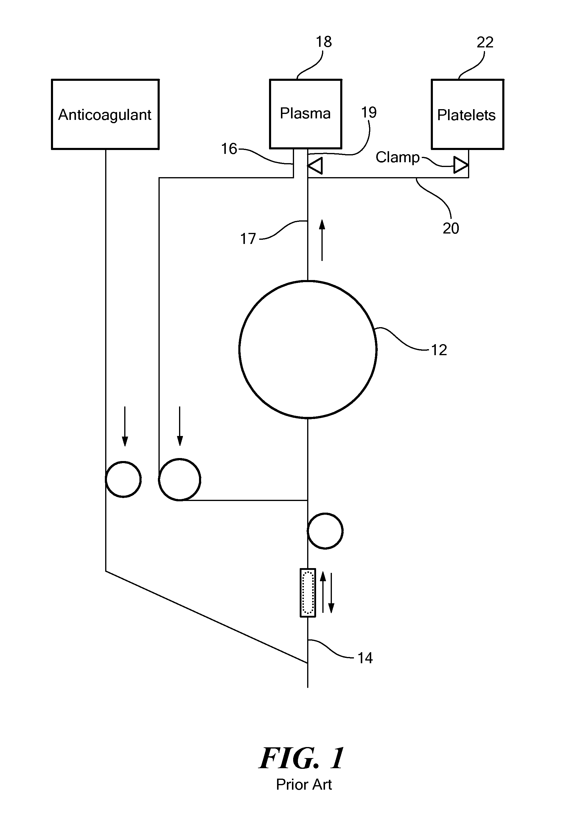 Three-Line Apheresis System and Method