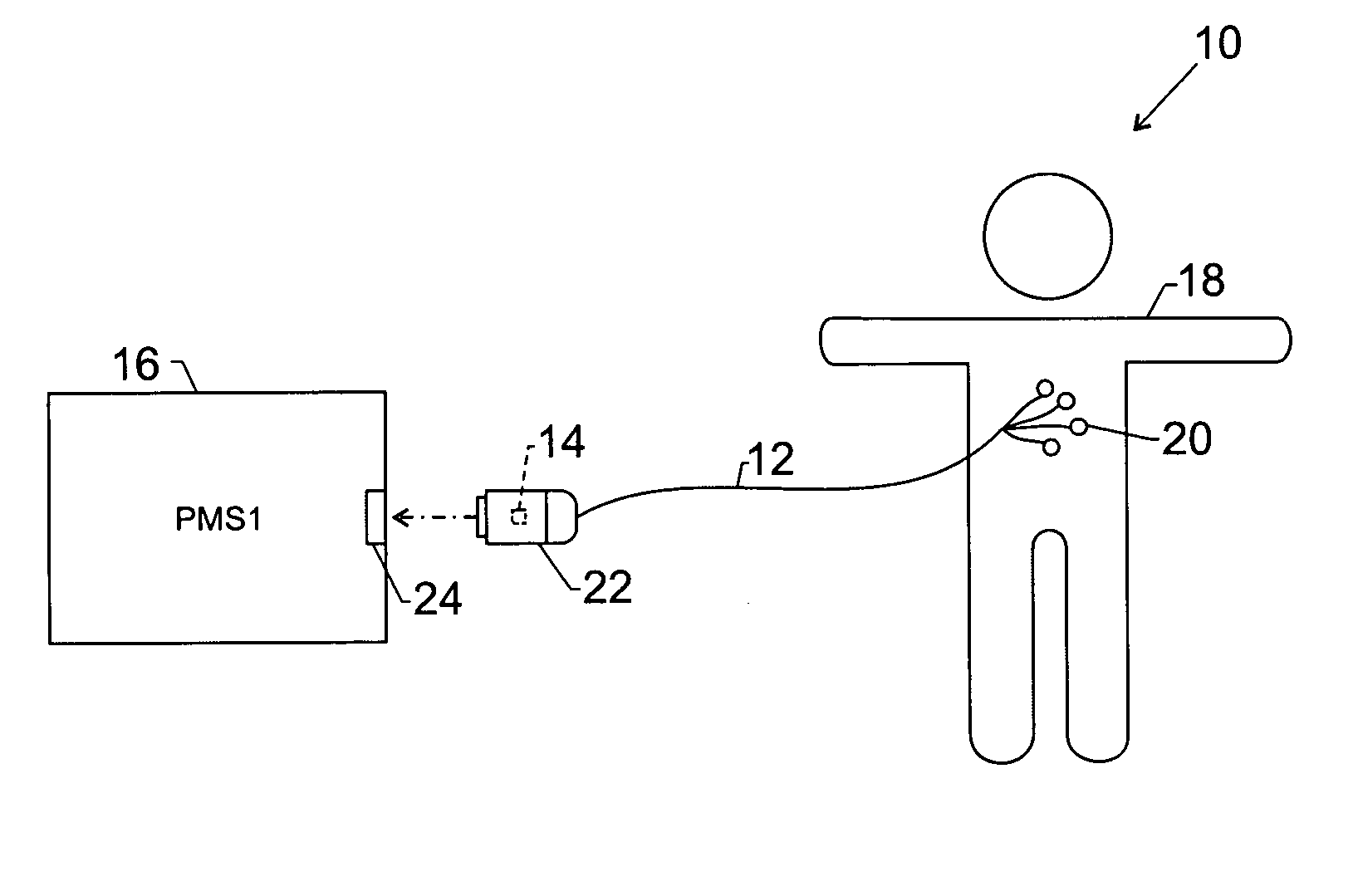 Patient monitoring system that incorporates memory into patient parameter cables