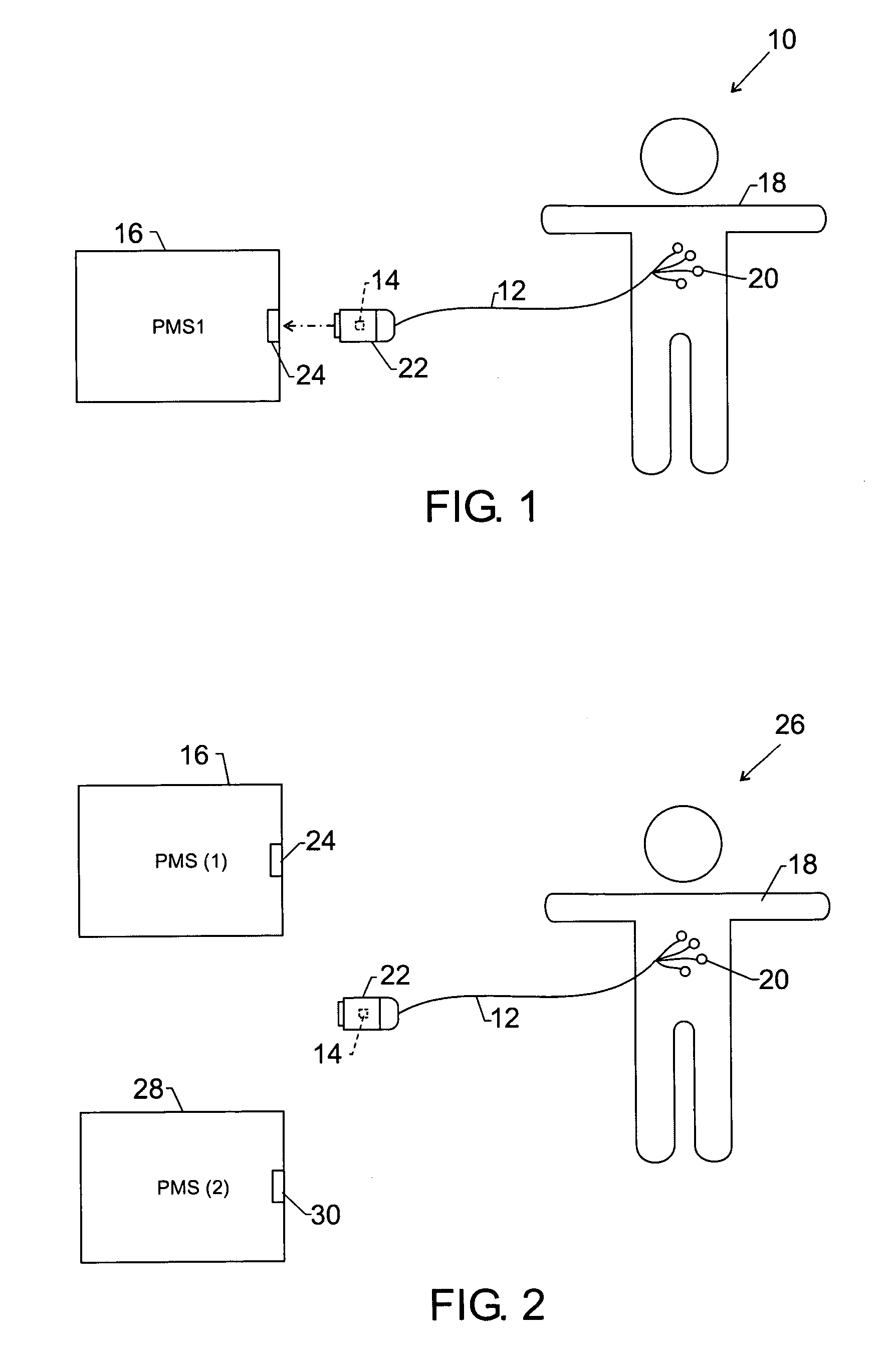 Patient monitoring system that incorporates memory into patient parameter cables