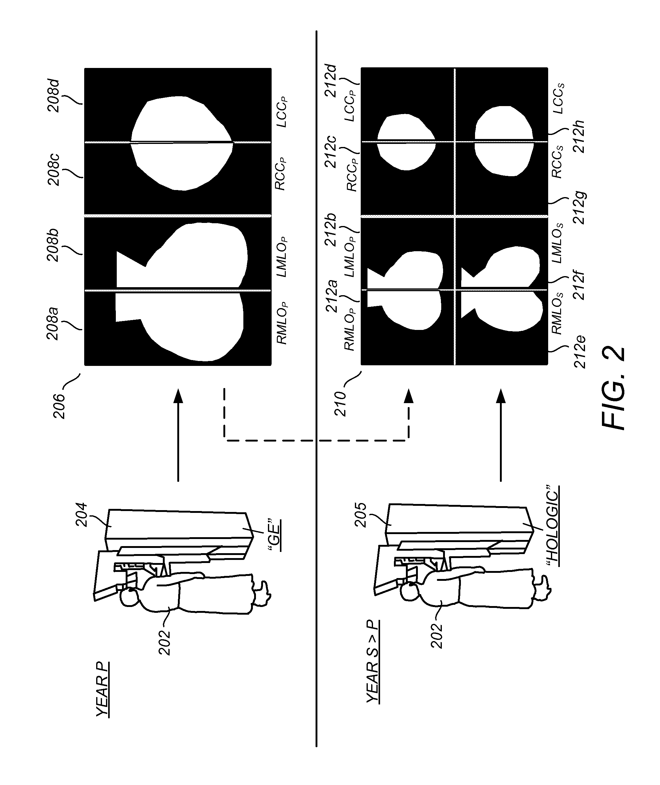 Facilitating Temporal Comparison of Medical Images