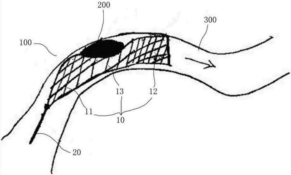 Clot retrieving support