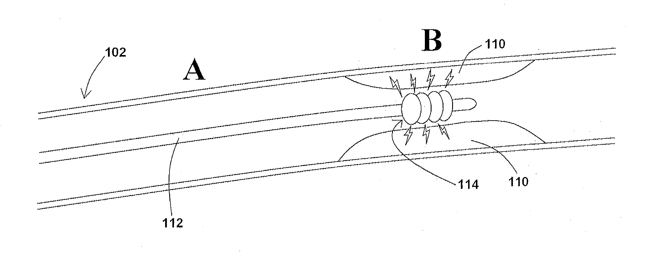 Devices, systems, and methods for removing targeted lesions from vessels