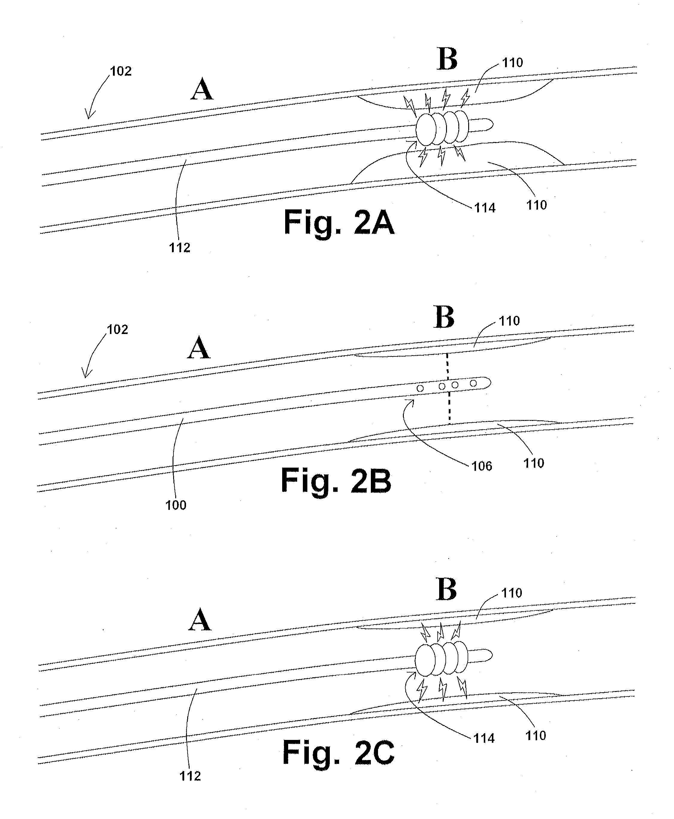 Devices, systems, and methods for removing targeted lesions from vessels