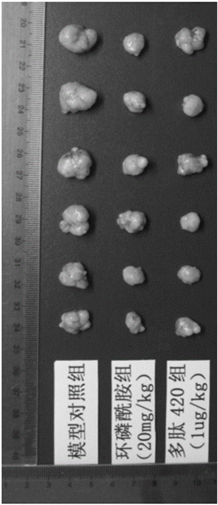 Human ribosomal protein RPS6 subunit anticancer peptide fragment and application thereof