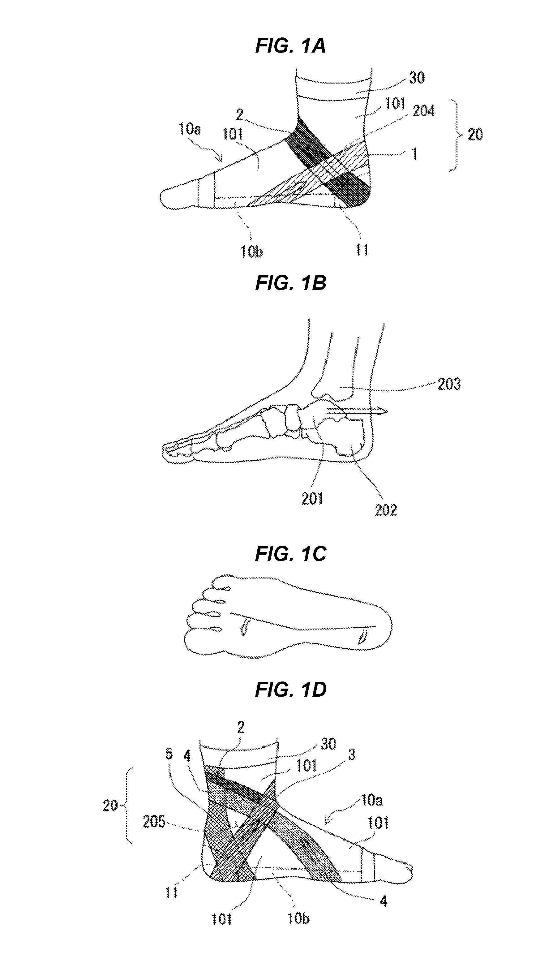 Foot joint supporter