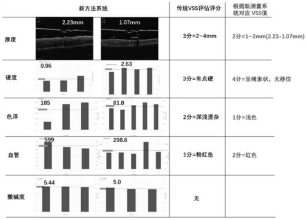 Scar assessment method and system