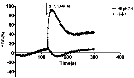 High-throughput screening method for progesterone response defect infertility human sperm samples