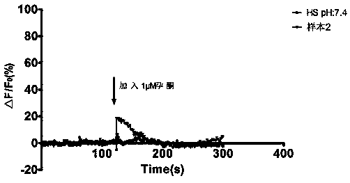 High-throughput screening method for progesterone response defect infertility human sperm samples