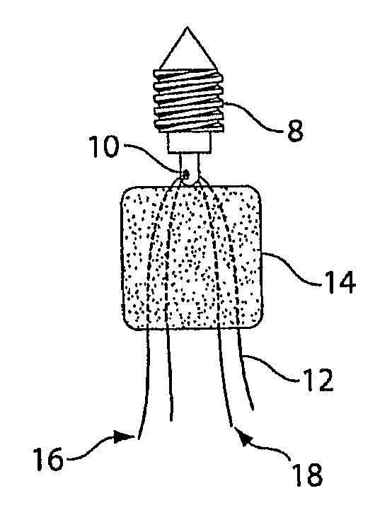 Methods and procedures for ligament repair